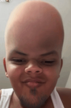 forehead-bald.gif